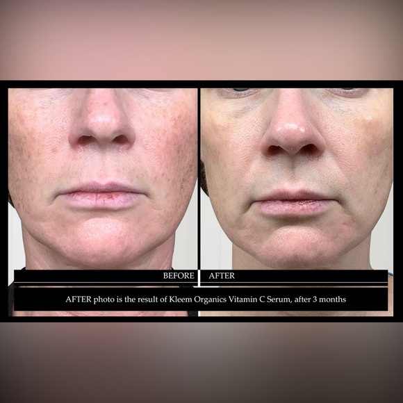 Kleem Organics VITAMIN C SERUM
For glowing and youthful skin - Picture 7 of 14